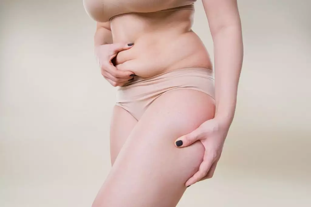 Liposuction (Yağ Alma) Nedir?