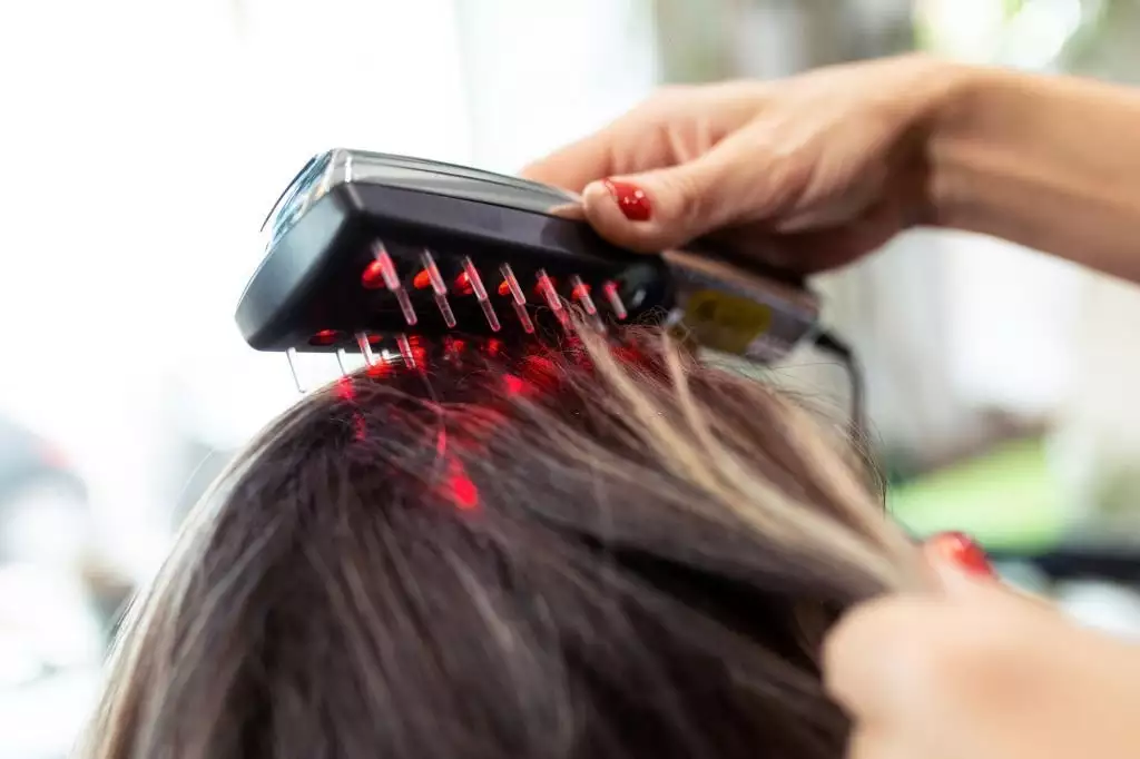 What is Hair Laser?